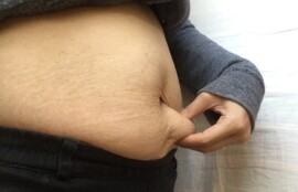 お腹の脂肪を指でつまんでいる様子。40代女性がダイエットの必要性を痛感する瞬間を象徴する、ウエスト周りの皮下脂肪の写真。