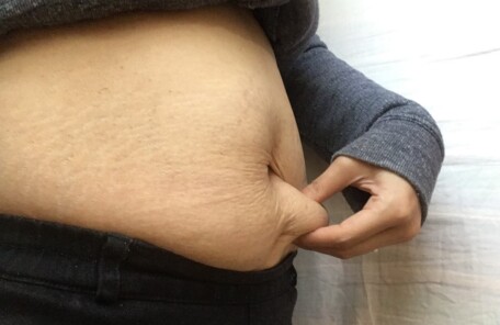 お腹の脂肪を指でつまんでいる様子。40代女性がダイエットの必要性を痛感する瞬間を象徴する、ウエスト周りの皮下脂肪の写真。